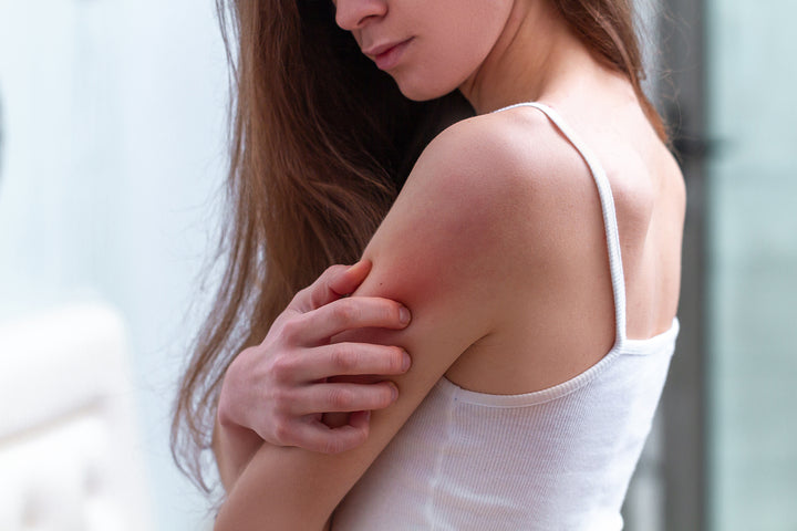 How Aroma Sense Can Help Improve Your Eczema